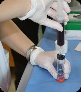 PRP trasferimento sangue